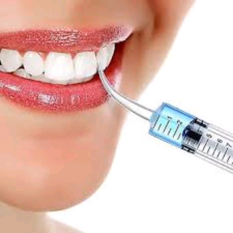 Teeth Cleaning Tool Elbow Syringe by Scantrik