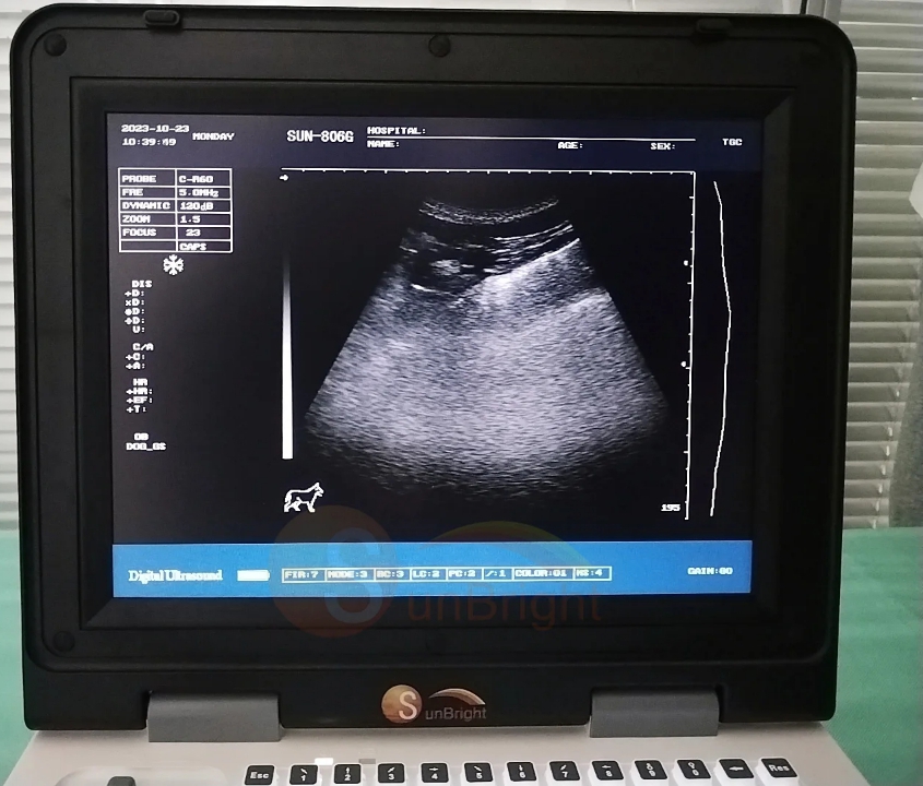 Best-Selling Sunbright Ultrasound Laptop by Scantrik