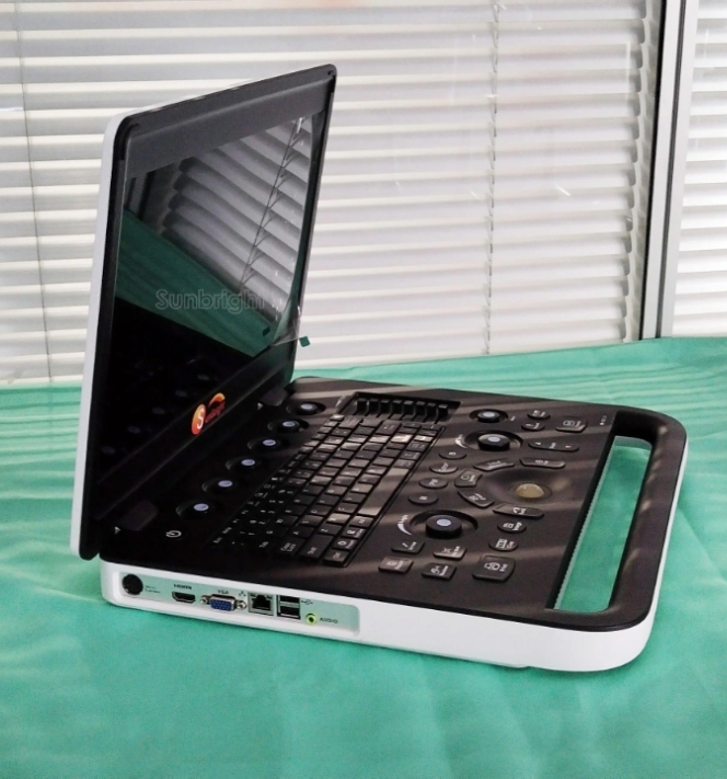 Clinic Sunbright Ultrasound Laptop by Scantrik