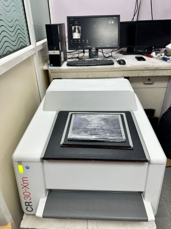 AGFA CR30-X with 2 Cassettes + Workstation by Scantrik
