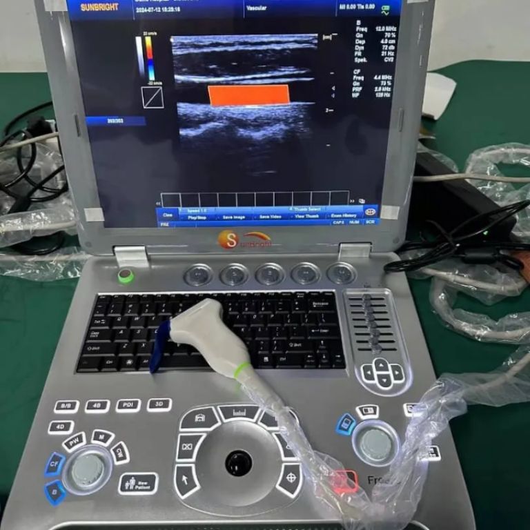 Sunbright Clinic Diagnosis Ultrasound with Convex Linear Probe( white & black) by Scantrik