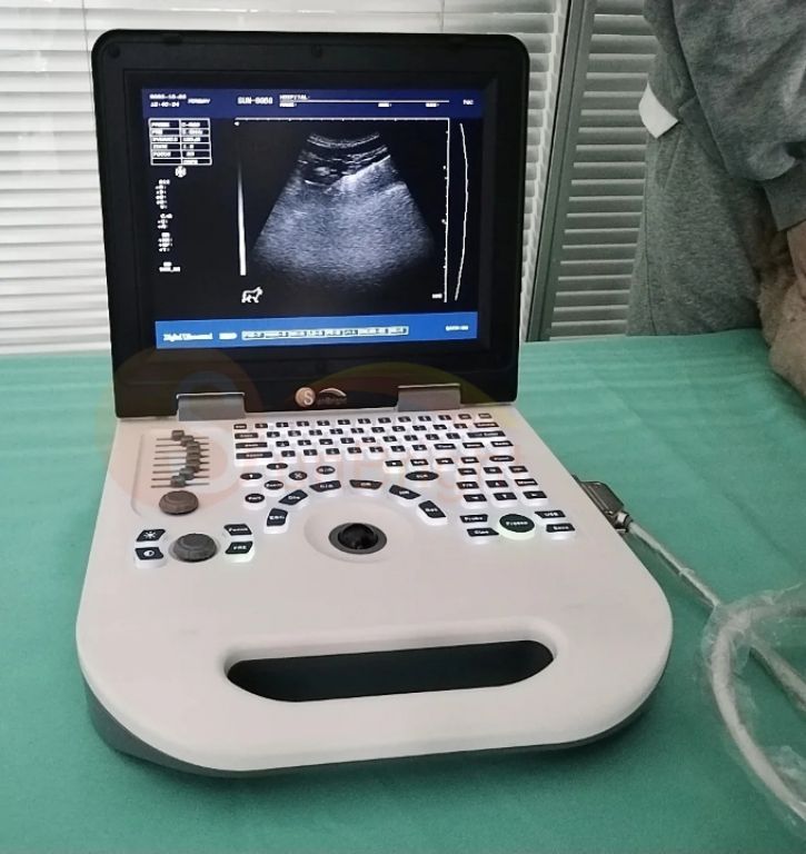 Portable Ultrasound Diagnosis Laptop by Scantrik