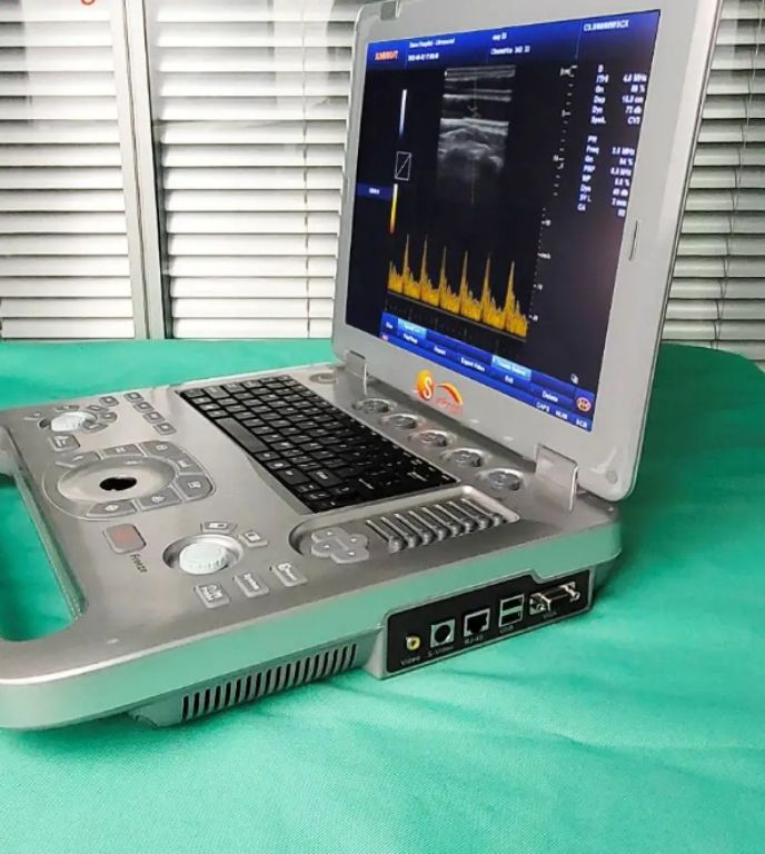Sunbright Full Digital Ultrasound Laptop by Scantrik