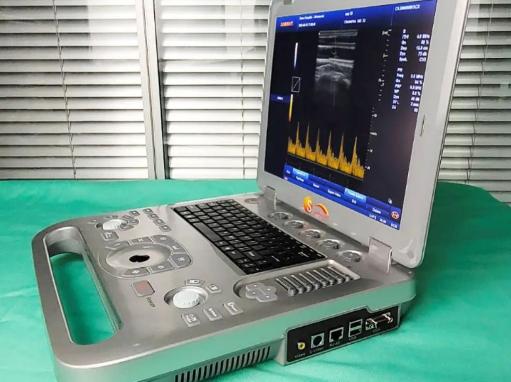Sunbright Hospital Ultrasound(white & black) by Scantrik
