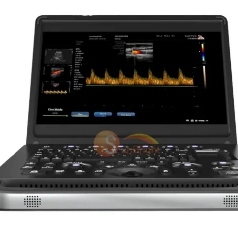 Ultrasound Sunbright Laptop by Scantrik