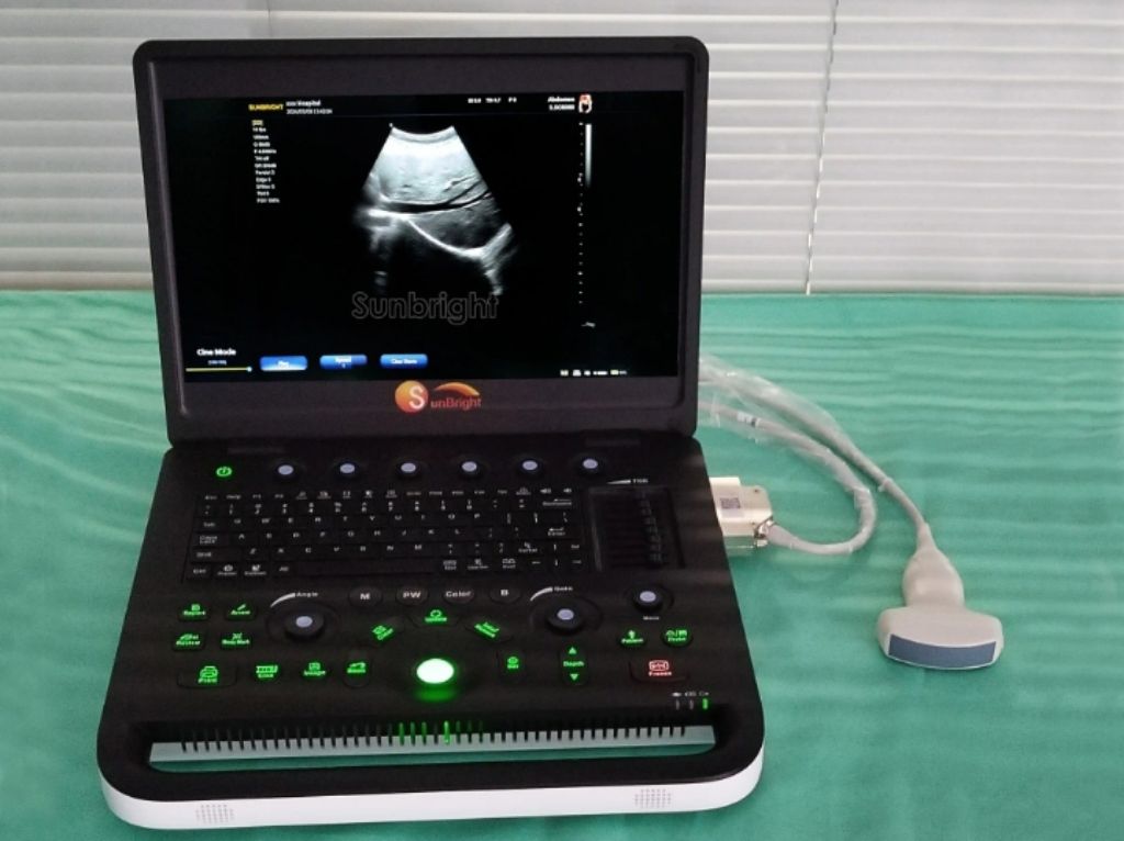 Popular Sunbright Ultrasound Machine by Scantrik