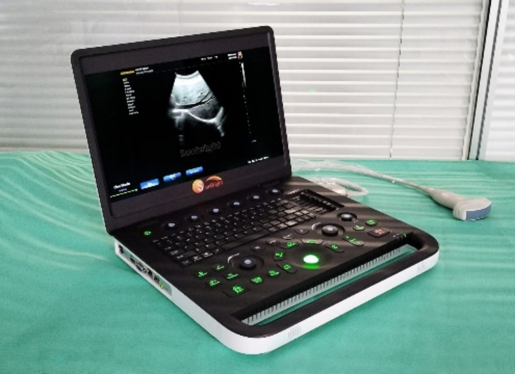 Sunbright Popular Ultrasound Machine by Scantrik