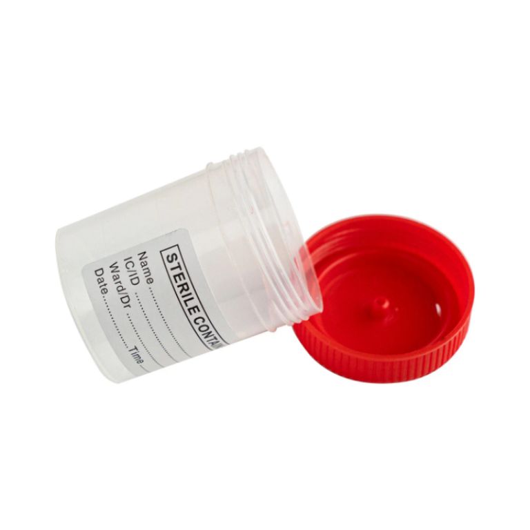 Best Quality Urine Container by Scantrik