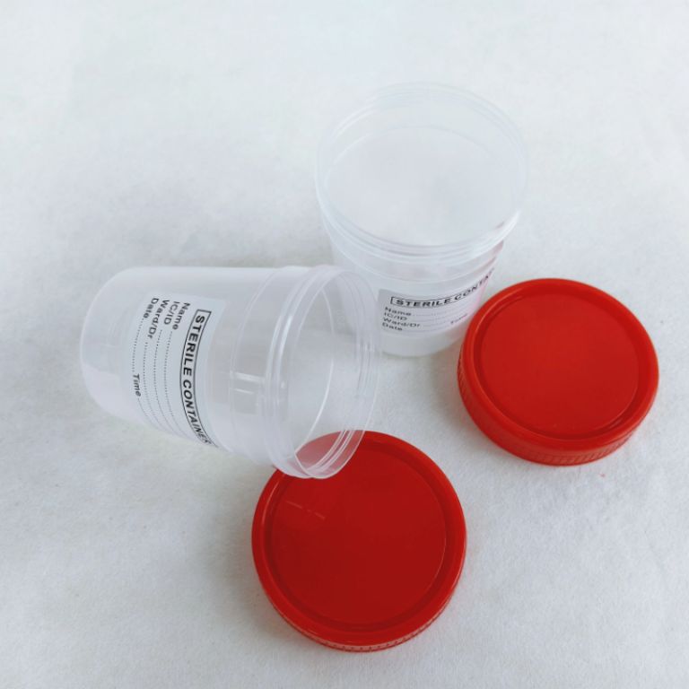 Hot Selling Urine Container 60ml by Scantrik