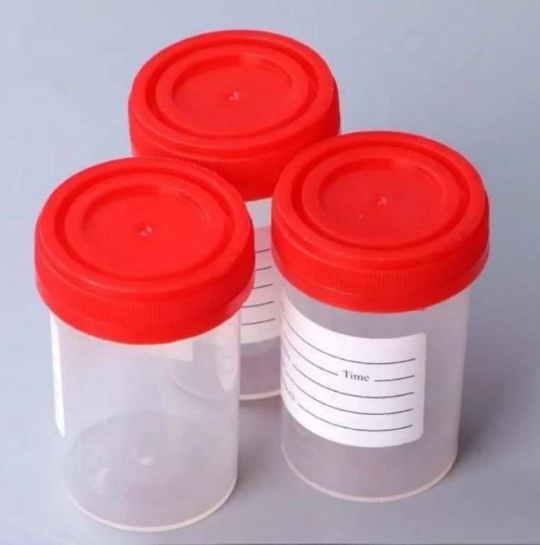 60ml Label Sample Urine Specimen Container by Scantrik