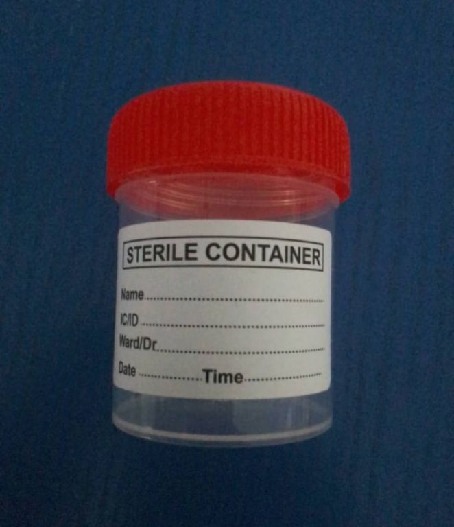 60ml Urine Container/Specimen Cup with Label by Scantrik