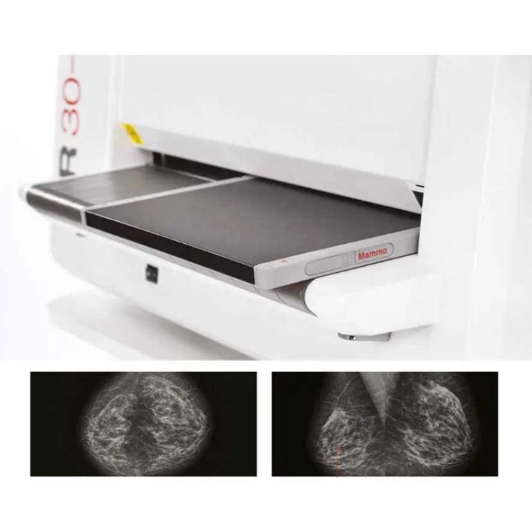 AGFA CR30-X with 2 Cassettes + Workstation Medical Imaging Equipment by Scantrik